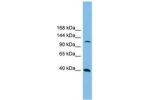 Image no. 1 for anti-Mitogen-Activated Protein Kinase Kinase Kinase 14 (MAP3K14) (AA 71-120) antibody (ABIN6744716) (MAP3K14 antibody  (AA 71-120))