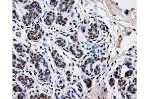 Immunohistochemical staining of paraffin-embedded breast tissue using anti-PKMYT1 mouse monoclonal antibody.