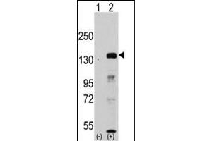Western blot analysis of JHDM1a/FBXL11 (arrow) using rabbit polyclonal JHDM1a/FBXL11 Antibody (Center) (ABIN387896 and ABIN2844142).