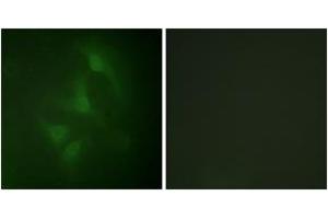Immunofluorescence analysis of HeLa cells, using JNK1/2/3 (Ab-183/185) Antibody. (JNK antibody  (AA 151-200))