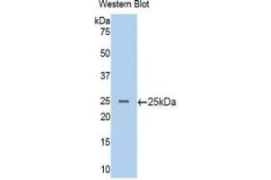 Western Blotting (WB) image for Phosphoinositide-3-Kinase, Catalytic, beta Polypeptide (PIK3CB) ELISA Kit (ABIN6574329)