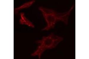 ABIN6275493 staining COLO205 cells by IF/ICC. (ARHGEF1 antibody  (N-Term))
