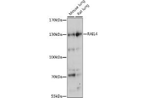 Western blot analysis of extracts of various cell lines, using R antibody (ABIN7269945) at 1:1000 dilution. (RAI14 antibody  (AA 300-600))