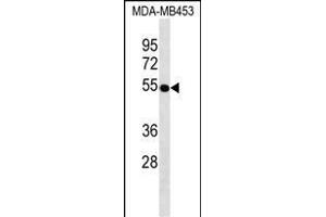 VDR Antibody ABIN1539943 western blot analysis in MDA-M cell line lysates (35 μg/lane). (Vitamin D Receptor antibody)