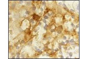 Immunohistochemistry (IHC) image for anti-CD209 (CD209) (Extracellular Domain) antibody (ABIN492510) (DC-SIGN/CD209 antibody  (Extracellular Domain))