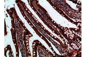 Immunohistochemical analysis of paraffin-embedded human-small-intestine, antibody was diluted at 1:200 (FABP2 antibody  (AA 90-132))