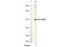 Western blot analysis of extracts from rat hippocampus tissue using MAPT polyclonal antibody . (MAPT antibody)