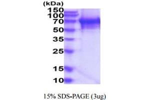 SDS-PAGE (SDS) image for Tyrosyl-DNA Phosphodiesterase 1 (TDP1) (AA 1-608) protein (His tag) (ABIN5777784)