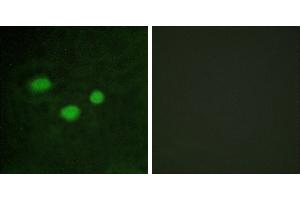 Peptide - +Immunofluorescence analysis of HeLa cells, using DNMT3B antibody. (DNMT3B antibody)