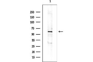 Western blot analysis of lysates from COLO205 cells(heat-shock treatment), using IL-20R alpha Antibody at 1/1000 dilution.