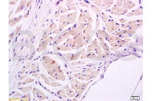 Formalin-fixed and paraffin embedded rat tongue tissue labeled with Anti-IL-17/IL-17A Polyclonal Antibody, Unconjugated (ABIN738891) at 1:600 followed by conjugation to the secondary antibody and DAB staining (IL-17 antibody  (AA 85-150))