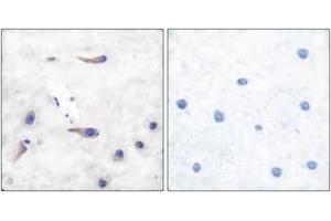 Immunohistochemistry analysis of paraffin-embedded human brain tissue, using MARCKS (Ab-163) Antibody. (MARCKS antibody  (AA 136-185))