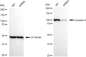Western blotting analysis using Dynamin 2 antibody (ABIN7798399).