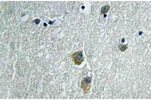 Immunohistochemistry (IHC) analyzes of PAKalpha antibody in paraffin-embedded human brain tissue. (PAK1 antibody)