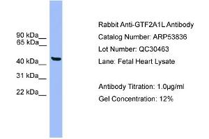 WB Suggested Anti-GTF2A1L  Antibody Titration: 0.