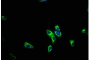 Immunofluorescence staining of HepG2 cells with ABIN7163295 at 1:200, counter-stained with DAPI. (PIK3R5 antibody  (Regulatory Subunit 5))