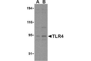 Image no. 1 for anti-Toll-Like Receptor 4 (TLR4) (N-Term) antibody (ABIN951277) (TLR4 antibody  (N-Term))