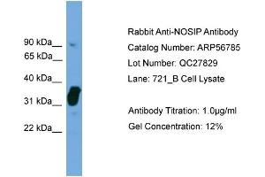 WB Suggested Anti-NOSIP  Antibody Titration: 0. (NOSIP antibody  (Middle Region))