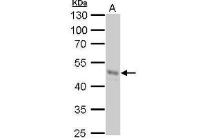 WB Image GNAS antibody [C2C3-2], C-term detects GNAS protein by Western blot analysis. (GNAS antibody)
