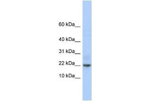 WB Suggested Anti-C9orf25 Antibody Titration: 0.