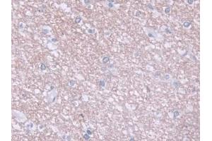 DAB staining on IHC-P; Samples: Human Cerebrum Tissue (CHRDL1 antibody  (AA 22-450))