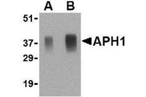 Western blot analysis of APH1 in human brain tissue lysate with AP30067PU-N APH1 antibody at (A) 0. (APH1A antibody  (Middle Region))