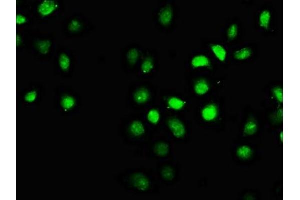 FANCI antibody  (AA 180-252)