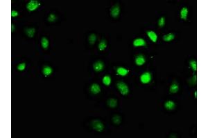 Immunofluorescence staining of A549 cells with ABIN7152557 at 1:66, counter-stained with DAPI. (FANCI antibody  (AA 180-252))