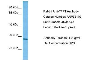Western Blotting (WB) image for anti-TCF3 (E2A) Fusion Partner (In Childhood Leukemia) (TFPT) (C-Term) antibody (ABIN2790046) (TFPT antibody  (C-Term))