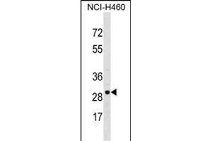VDAC3 抗体  (AA 156-183)