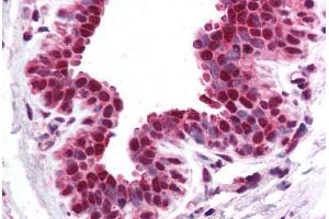 Human Breast (formalin-fixed, paraffin-embedded) stained with CACNB1 antibody ABIN214731 at 5 ug/ml followed by biotinylated goat anti-rabbit IgG secondary antibody ABIN481713, alkaline phosphatase-streptavidin and chromogen. (CACNB1 antibody  (AA 21-70))