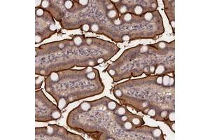 Immunohistochemical staining of human duodenum with TMC5 polyclonal antibody  shows cytoplasmic and membranous positivity in glandular cells at 1:200-1:500 dilution.