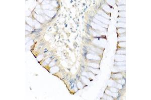 Immunohistochemistry of paraffin-embedded human colon using CPA1 antibody at dilution of 1:100 (40x lens).