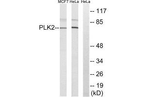 Western Blotting (WB) image for anti-Polo-Like Kinase 2 (PLK2) (Internal Region) antibody (ABIN1852099) (PLK2 antibody  (Internal Region))