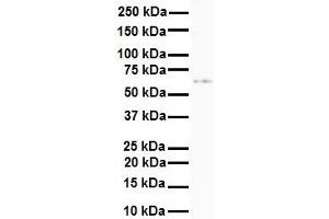 WB Suggested Anti-SLC7A1 antibody Titration: 1 ug/mL Sample Type: Human 721_B (SLC7A1 antibody  (N-Term))