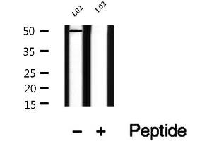 Western blot analysis of extracts of L02 cells, using TRIM14 antibody.