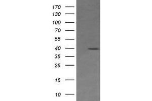 Image no. 1 for anti-Mitogen-Activated Protein Kinase Kinase 3 (MAP2K3) antibody (ABIN1499408) (MAP2K3 antibody)