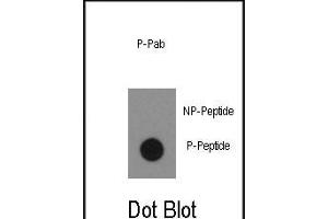 Dot blot analysis of anti-Phospho-ABL1- Antibody (ABIN389501 and ABIN2839559) on nitrocellulose membrane. (ABL1 antibody  (pTyr134))