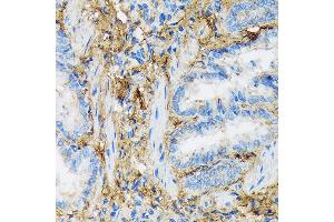 Immunohistochemistry of paraffin-embedded rat lung using Collagen VI/COL6 Rabbit mAb (ABIN7266462) at dilution of 1:100 (40x lens). (COL6A1 antibody)