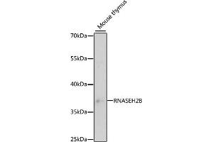 Western blot analysis of extracts of mouse thymus, using RNB antibody (ABIN6133304, ABIN6146990, ABIN6146991 and ABIN6220814) at 1:3000 dilution. (RNASEH2B antibody  (AA 1-290))