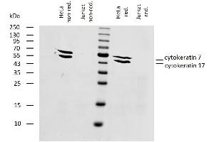 Western blotting analysis of human cytokeratin 7+17 using mouse monoclonal antibody C-46 on lysates of HeLa cell line and Jurkat cell line (cytokeratin non-expressing cell line; negative control) under non-reducing and reducing conditions.