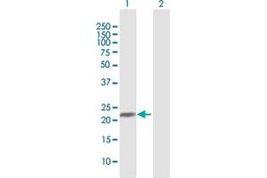Western Blot analysis of C9orf95 expression in transfected 293T cell line by C9orf95 MaxPab polyclonal antibody. (NMRK1 antibody  (AA 1-199))