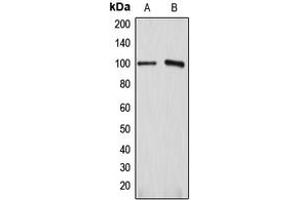 Western blot analysis of ATP1A1 expression in HEK293T (A), HeLa (B) whole cell lysates.
