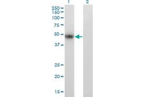 Western Blot analysis of PAX8 expression in transfected 293T cell line by PAX8 monoclonal antibody (M23), clone 2F1.