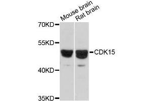 Western blot analysis of extracts of various cell lines, using CDK15 antibody (ABIN6292714) at 1:3000 dilution.