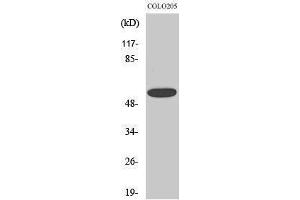 Western Blotting (WB) image for anti-Chloride Channel CLIC-Like 1 (CLCC1) (Internal Region) antibody (ABIN3174437) (CLCC1 antibody  (Internal Region))