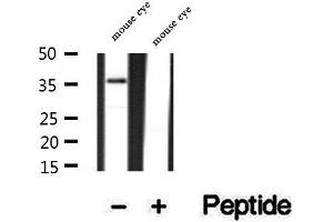 PRPH2 anticorps  (Internal Region)