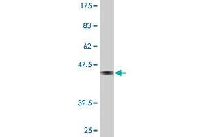 Western Blot detection against Immunogen (45. (PDAP1 antibody  (AA 1-181))