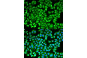 Immunofluorescence analysis of A549 cells using KAT5 antibody (ABIN6292501). (KAT5 antibody)