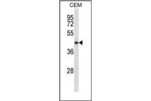 Western blot analysis of NDRG2 Antibody (N-term) in CEM cell line lysates (35ug/lane). (NDRG2 antibody  (N-Term))